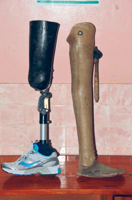 Prothesen im Vergleich: Während die linke Prothese eine Beugung zulässt und mehr Gewicht halten kann, ist die rechte Prothese steif und brüchig. Foto: privat