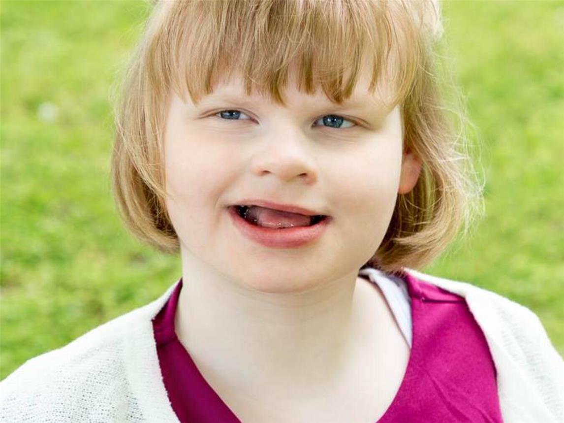 Auch Lea aus Ossenberg hat das „Angelman-Syndrom“.Foto: Peter Meulmann
