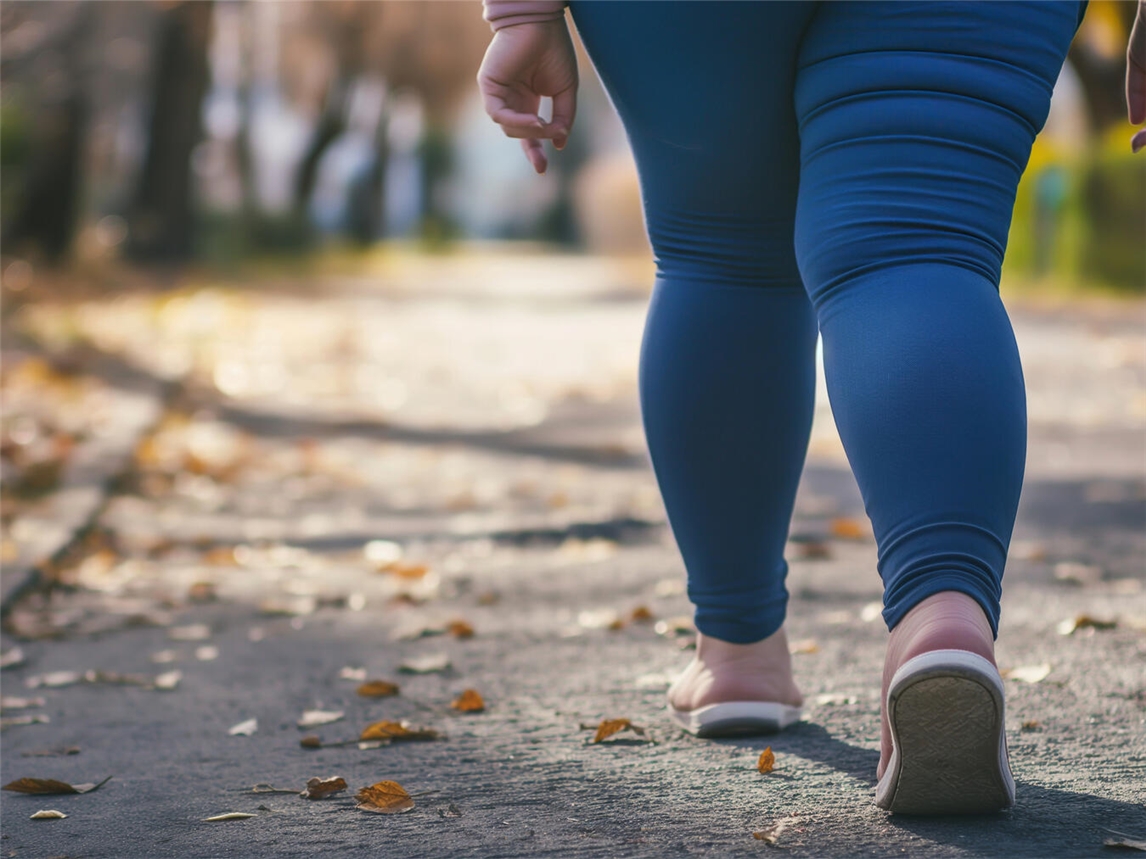Tausende von Frauen leiden tagtäglich unter den Schmerzen und Einschränkungen des Lipödems. Foto: Adobe Stock